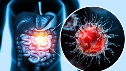 Erken Yaşta Kanser Vakasında Korkunç Artış 