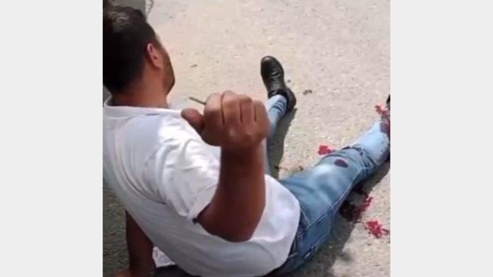 Pütürge'deki Silahlı Yaralamada Şoke Eden Video Detayı!