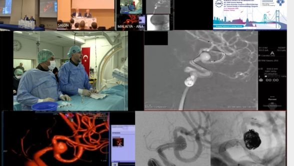 Malatya ekibinden canlı yayında beyin ameliyatı